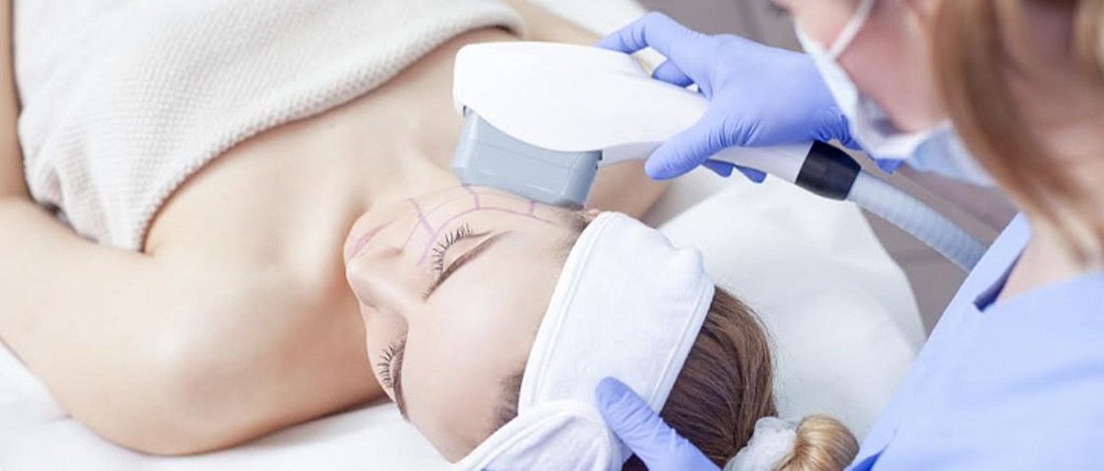 PRP Facial Rejuvenation Treatment - Adore Skin Clinic